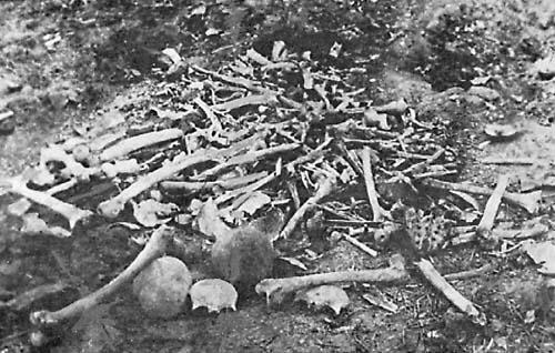 Remains of Armenian Dead at Erzincan, Turkey, 1918