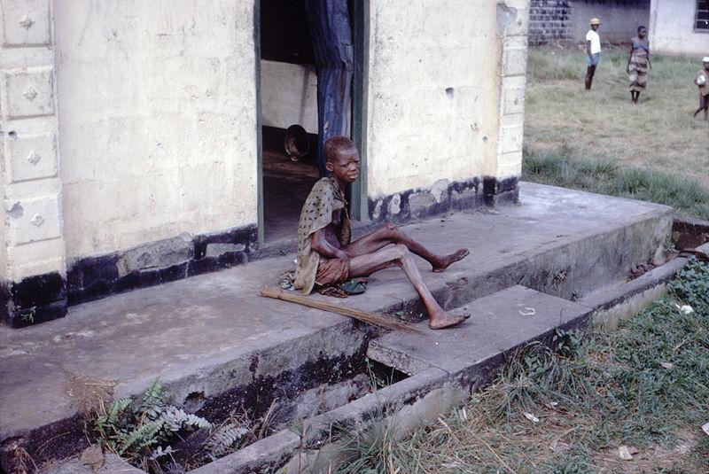 Starvation in Biafra