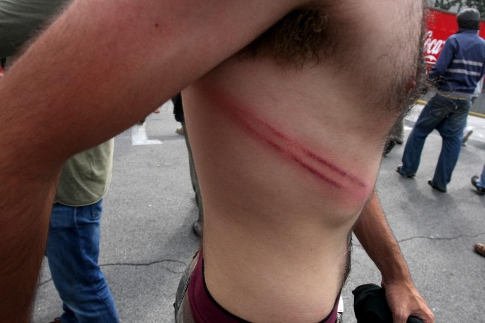 Barcelona Protest Camp Crackdown 2011
